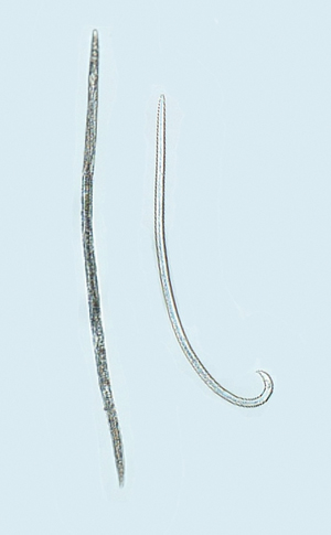 Figure 4. Microscopic (50x magnification) view a female (left) and male (right) pinewood nematode.