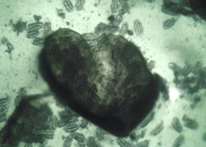 Figure 6. Cyst (dead female) of sugar beet cyst nematode broken open to reveal eggs. 