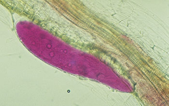 Figure 7. Swollen third stage juvenile breaks outside the root with head still embedded for feeding (stained with acid fuchsin).