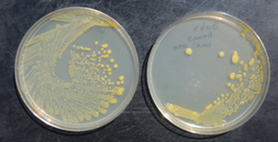 Figure 6. Bright lemon-yellow bacterial colonies characteristic of the common blight pathogen growing in culture. 