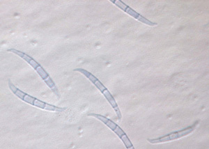 Figure 2. Microscopic view of spores (conidia) of Fusarium graminearum. 