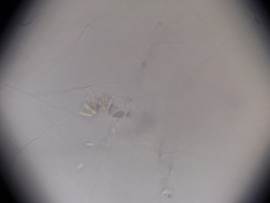 Figure 4. Microscopic view of spores (conidia) of Fusarium verticillioides.