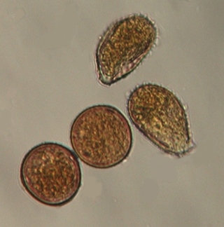 Figure 4. Urediniospores (magnified 400X) of P. sorghi (common rust, lower left) and P. polysora (southern rust, upper right). (Photo courtesy of Amy Timmerman, UNL Extension). 