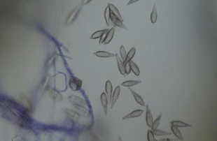 Figure 2. Microscopic view of Pyricularia grisea conidia.