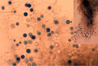 Figure 12. Light microscopy of small infected feeder root. Circular, darkly stained structures are overwintering oospores