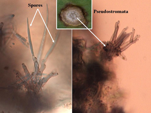 Figure 3. Microscopic side view of pseudostromata (spore-bearing structures) with spores attached (left) and empty (right).