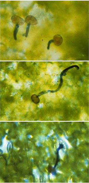 Figure 8. From the top, sequence of urediniopsores germinating and penetrating leaf surface through stomates