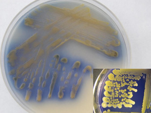 Figure 9. Young wilt pathogen culture exhibiting purple color variant.