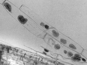 Figure 7.	Cystosori of BNYVV vector, Polymyxa betae, in epidermal cells of infested small sugar beet feeder root. 