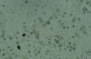 Figure 6.	Overwintering survival structures of F. oxysporum (Chlamydospores).