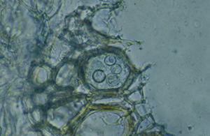 Figure 7. Chlamydospores found lugging xylem elements.