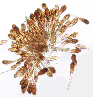 Figure 4. 200x magnification of teliospores produced on cordgrass. 