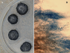 Figure 11. (a) Characteristic colony growth in culture of V. dahliae, consisting of masses of black microsclerotia and (b) Mycelial growth of V. dahliae showing conversion of hyphal cells into irregular-shaped microsclerotia. 