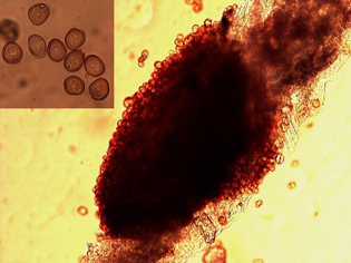 Figure 3. Microscopic thin section from an infected sunflower leaf showing a uredial pustule producing urediospores. Close-up of single-celled urediospores (inset).