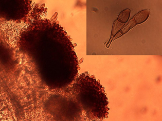 Figure 4. Microscopic thin section from an infected sunflower leaf showing a telial pustule producing teliospores. Close-up of two-celled teliospores (inset).