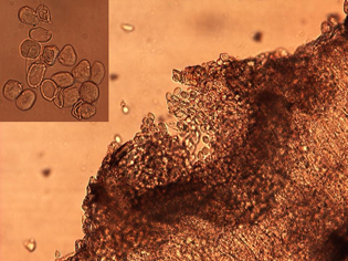 Figure 7. Microscopic thin section from an infected sunflower leaf showing an aecial pustule producing aeciospores. Close-up of single-celled aeciospores (inset). 