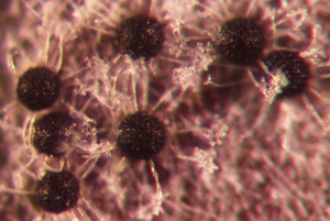 Figure 4. Cleistothecia on the viburnum leaf surface at 12x magnification.