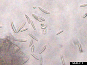 Figure 4. Conidia of Dothistroma pini.