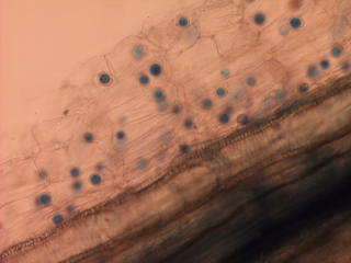 Figure 15. Overwintering survival structures (oospores) embedded in root tissue. 