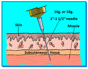 G2159-2 Intramuscular Injection