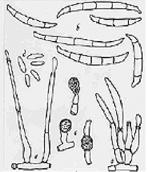 Figure 6. Microscopic view of spores (conidia) of Fusarium virguliforme.